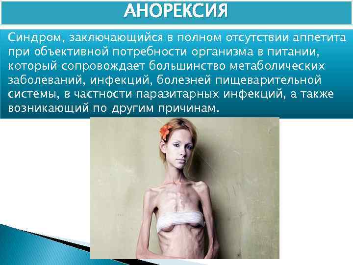 АНОРЕКСИЯ Синдром, заключающийся в полном отсутствии аппетита при объективной потребности организма в питании, который