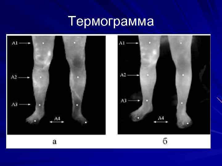 Термограмма 