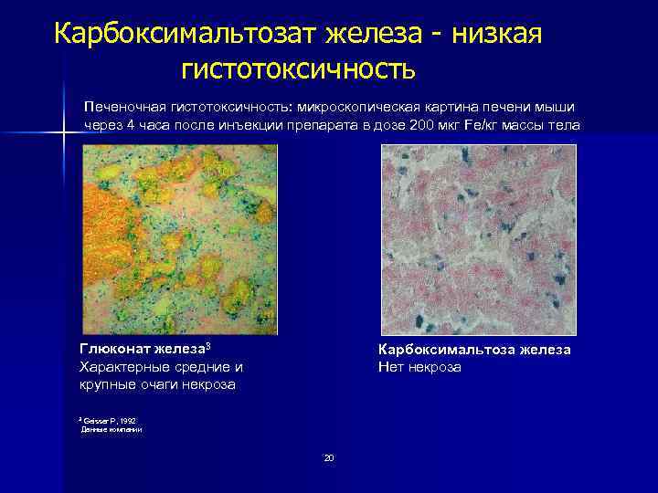 Карбоксимальтозат железа - низкая гистотоксичность Печеночная гистотоксичность: микроскопическая картина печени мыши через 4 часа