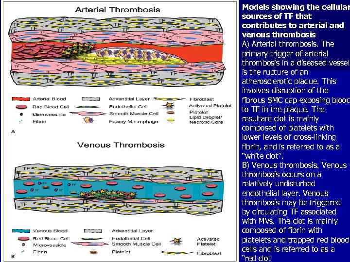 Models showing the cellular sources of TF that contributes to arterial and venous thrombosis