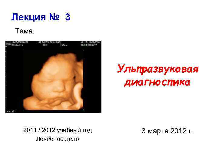 Лекция № 3 Тема: Ультразвуковая диагностика 2011 / 2012 учебный год Лечебное дело 3