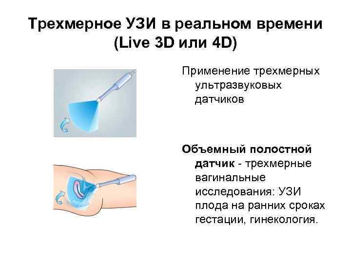 Трехмерное УЗИ в реальном времени (Live 3 D или 4 D) Применение трехмерных ультразвуковых