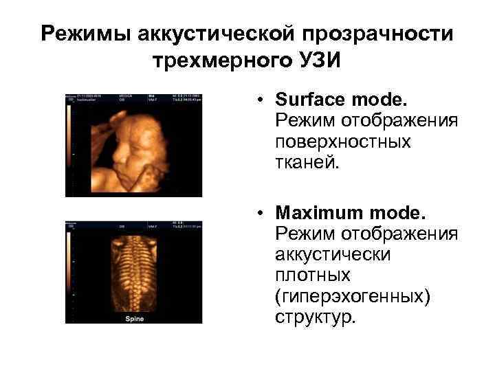 Режимы аккустической прозрачности трехмерного УЗИ • Surface mode. Режим отображения поверхностных тканей. • Maximum