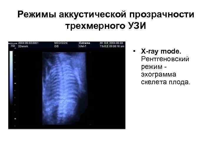 Презентация про узи