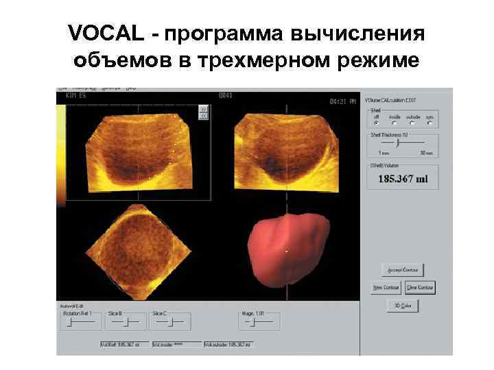 VOCAL - программа вычисления объемов в трехмерном режиме 