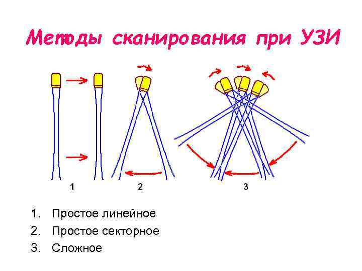 Методы сканирования при УЗИ 1. Простое линейное 2. Простое секторное 3. Сложное 