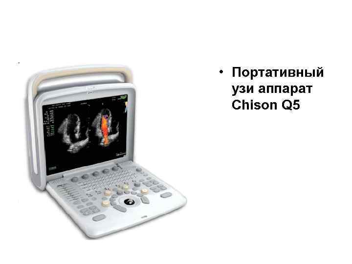  • Портативный узи аппарат Chison Q 5 