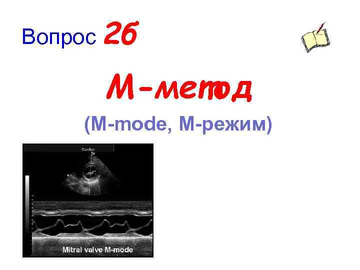 Вопрос 2 б М-метод (M-mode, M-режим) 