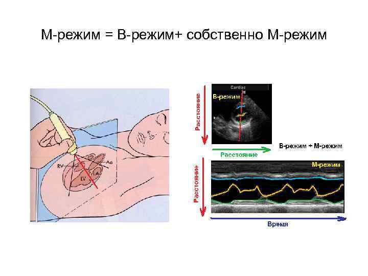 Ультразвуковая диагностика презентация