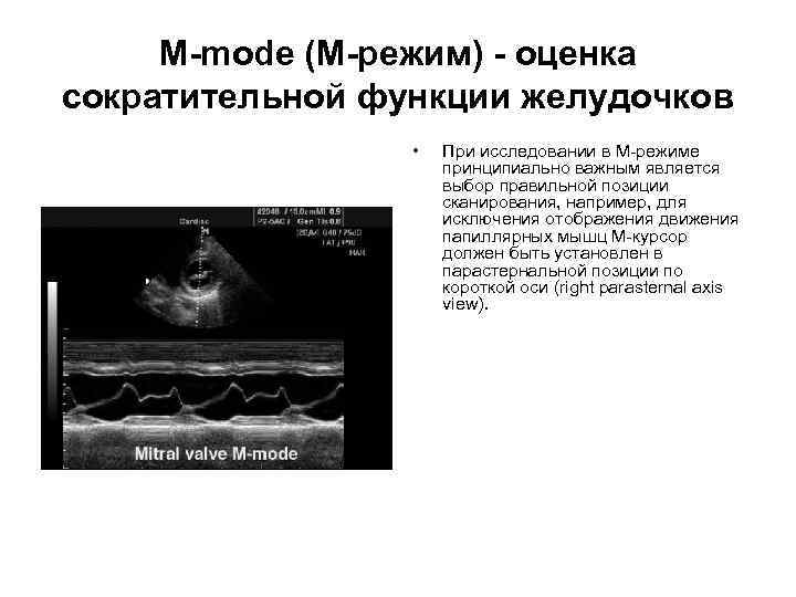 Ультразвуковая диагностика презентация