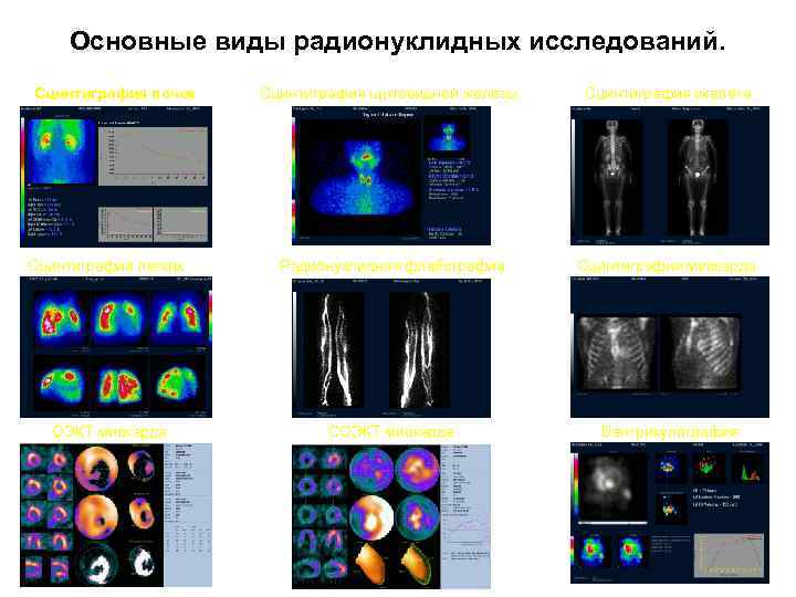 Основные виды радионуклидных исследований. Сцинтиграфия почек Сцинтиграфия щитовидной железы Сцинтиграфия скелета Сцинтиграфия легких Радионуклидная