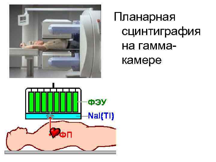 Планарная сцинтиграфия на гаммакамере 