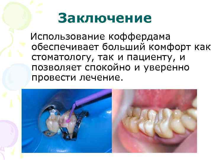 Заключение Использование коффердама обеспечивает больший комфорт как стоматологу, так и пациенту, и позволяет спокойно