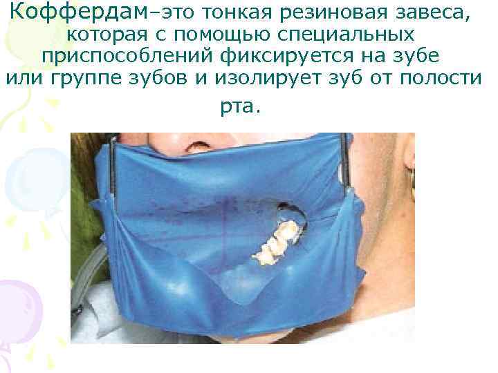 Коффердам–это тонкая резиновая завеса, которая с помощью специальных приспособлений фиксируется на зубе или группе