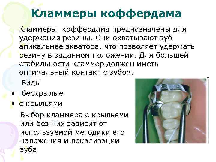 Кламмеры коффердама предназначены для удержания резины. Они охватывают зуб апикальнее экватора, что позволяет удержать