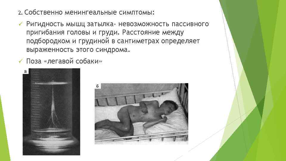 2. Собственно менингеальные симптомы: ü Ригидность мышц затылка- невозможность пассивного пригибания головы и груди.