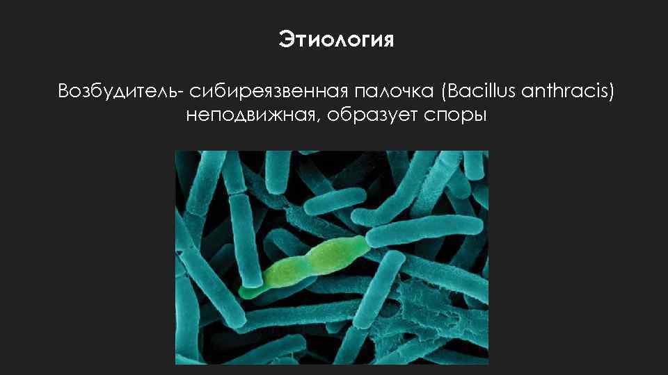 Этиология Возбудитель- сибиреязвенная палочка (Bacillus anthracis) неподвижная, образует споры 