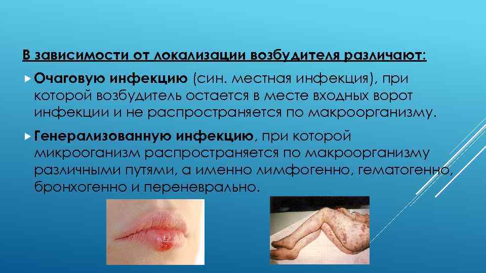 В зависимости от локализации возбудителя различают: Очаговую инфекцию (син. местная инфекция), при которой возбудитель