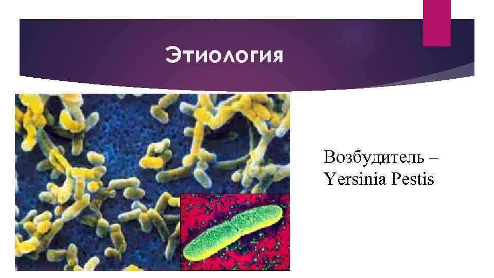 Этиология Возбудитель – Yersinia Pestis 