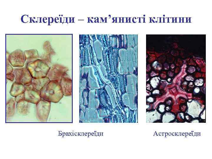 Склереїди – кам’янисті клітини Брахісклереїди Астросклереїди 