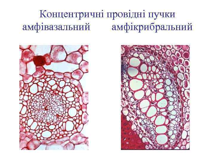 Концентричні провідні пучки амфівазальний амфікрибральний 