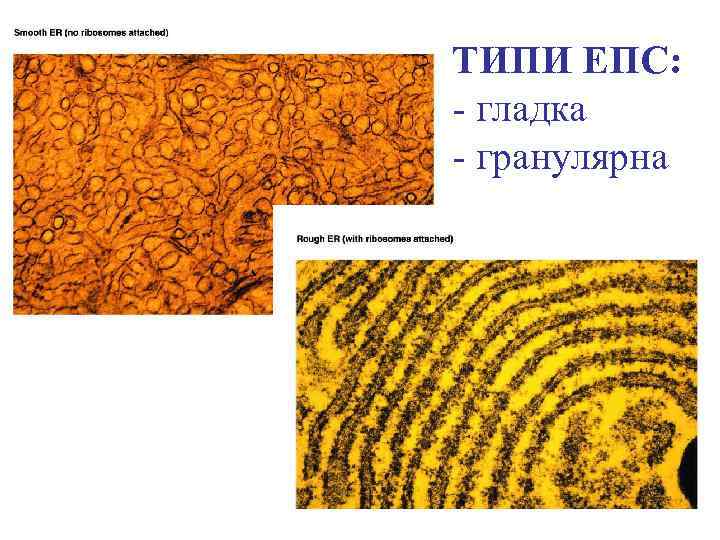 ТИПИ ЕПС: - гладка - гранулярна 