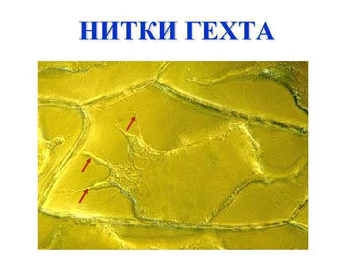 НИТКИ ГЕХТА 