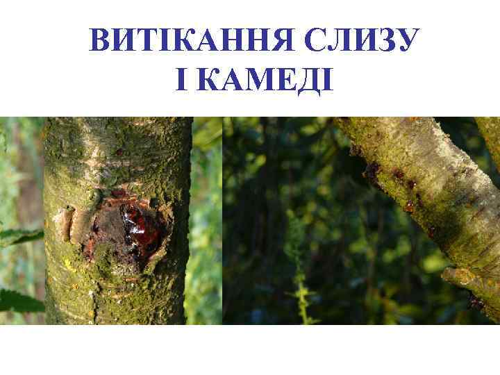 ВИТІКАННЯ СЛИЗУ І КАМЕДІ 