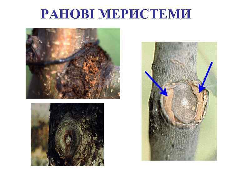 РАНОВІ МЕРИСТЕМИ 