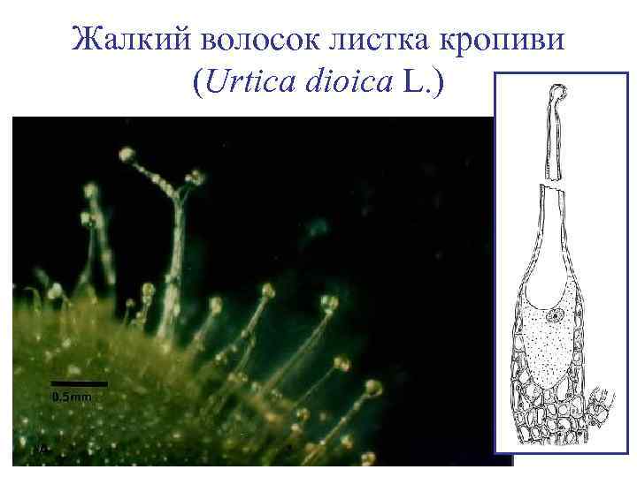 Жалкий волосок листка кропиви (Urtica dioica L. ) 