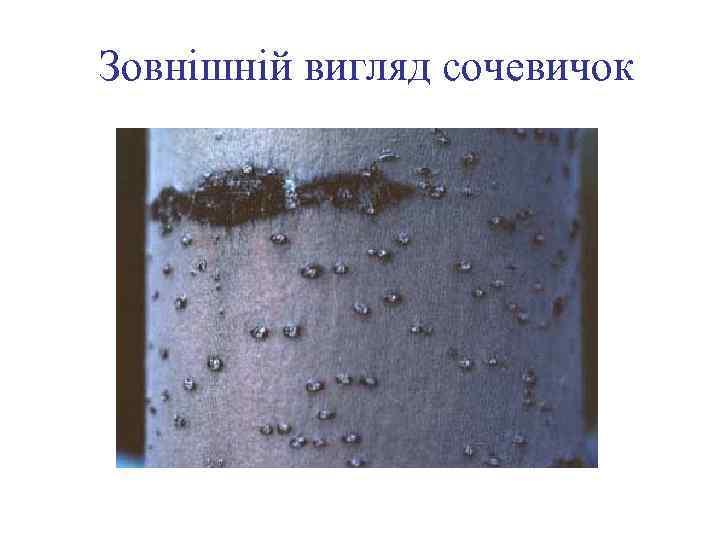 Зовнішній вигляд сочевичок 