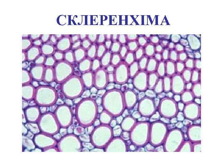 СКЛЕРЕНХІМА 