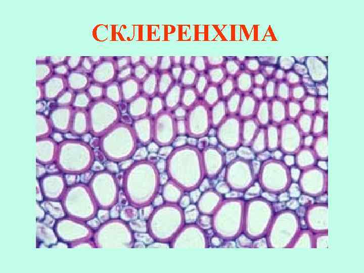 СКЛЕРЕНХІМА 
