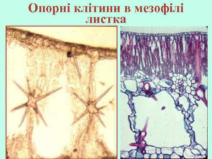 Опорні клітини в мезофілі листка 