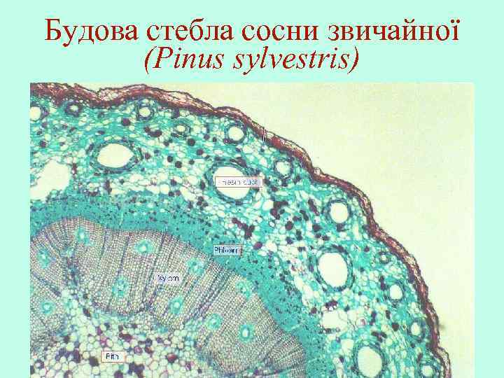 Будова стебла сосни звичайної (Pinus sylvestris) 