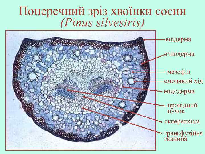 Поперечний зріз хвоїнки сосни (Pinus silvestris) епідерма гіподерма мезофіл смоляний хід ендодерма провідний пучок
