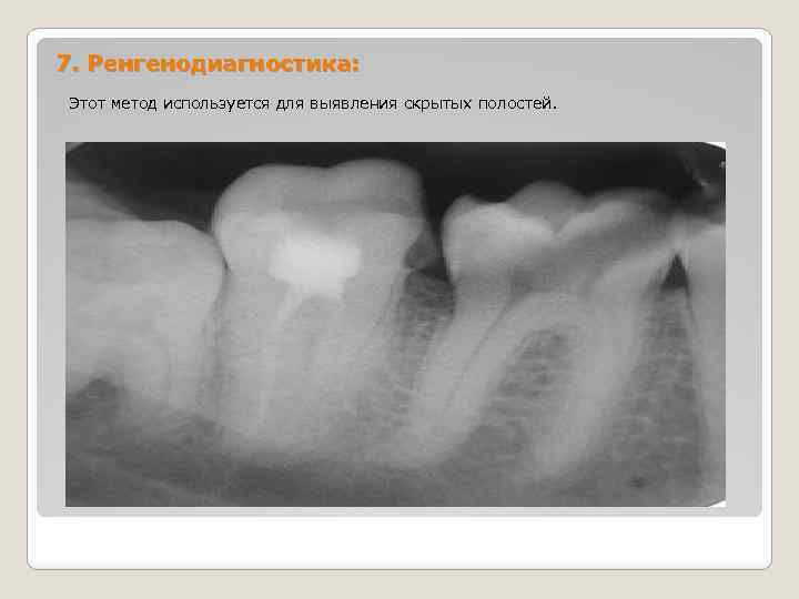 7. Ренгенодиагностика: Этот метод используется для выявления скрытых полостей. 
