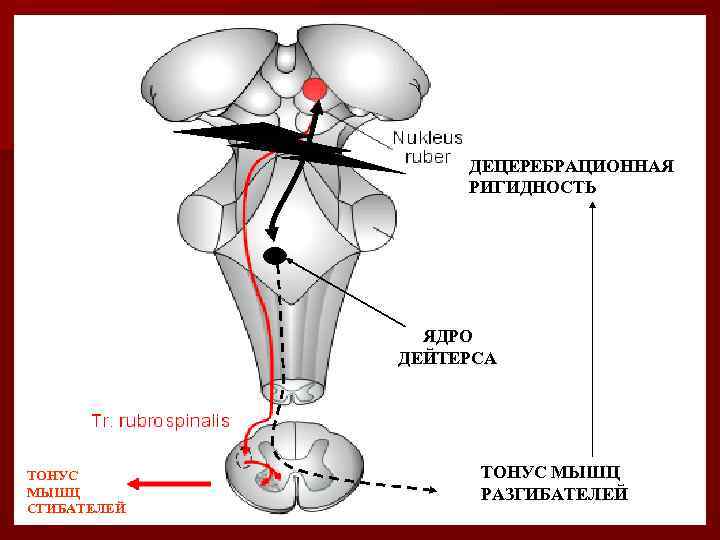 ДЕЦЕРЕБРАЦИОННАЯ РИГИДНОСТЬ ЯДРО ДЕЙТЕРСА ТОНУС МЫШЦ СГИБАТЕЛЕЙ ТОНУС МЫШЦ РАЗГИБАТЕЛЕЙ 