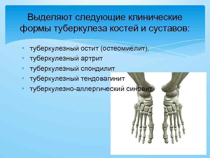 Выделяют следующие клинические формы туберкулеза костей и суставов: • • • туберкулезный остит (остеомиелит),