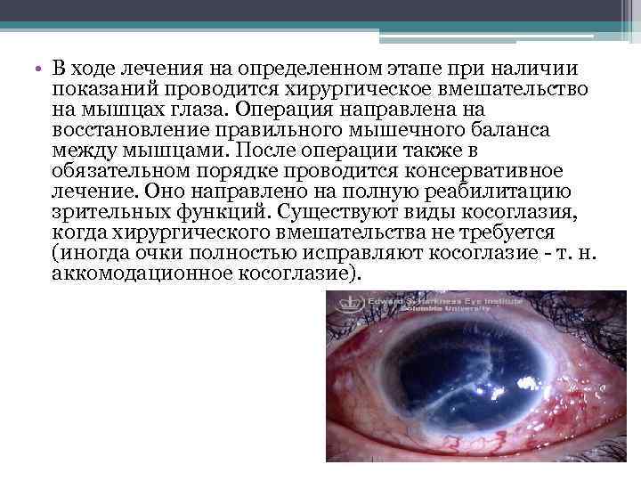  • В ходе лечения на определенном этапе при наличии показаний проводится хирургическое вмешательство