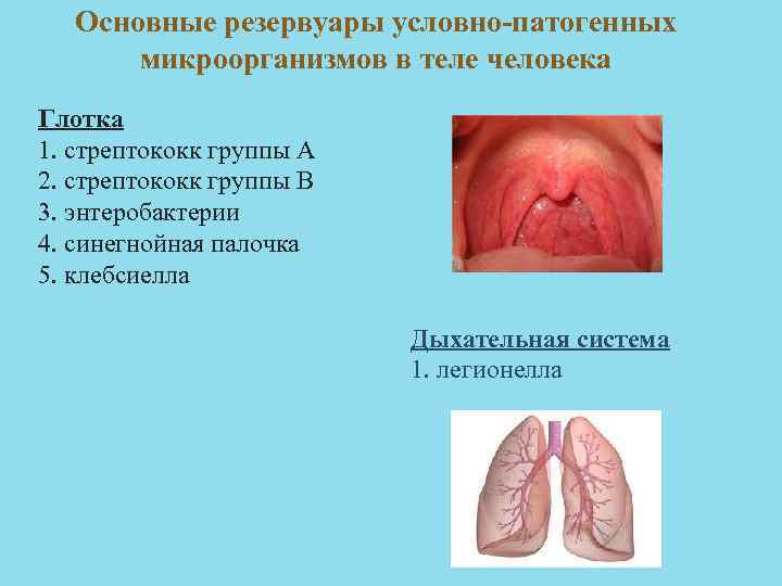 Основные резервуары условно патогенных микроорганизмов в теле человека Глотка 1. стрептококк группы А 2.