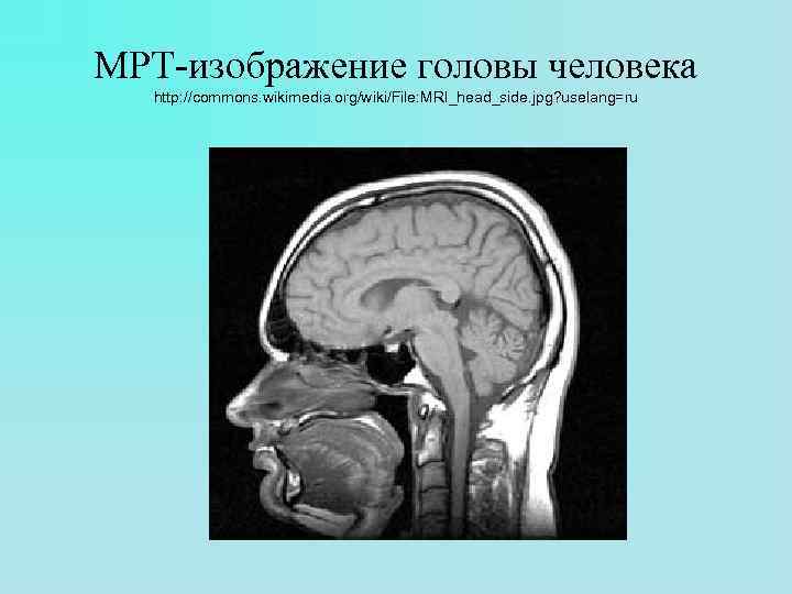 МРТ-изображение головы человека http: //commons. wikimedia. org/wiki/File: MRI_head_side. jpg? uselang=ru 