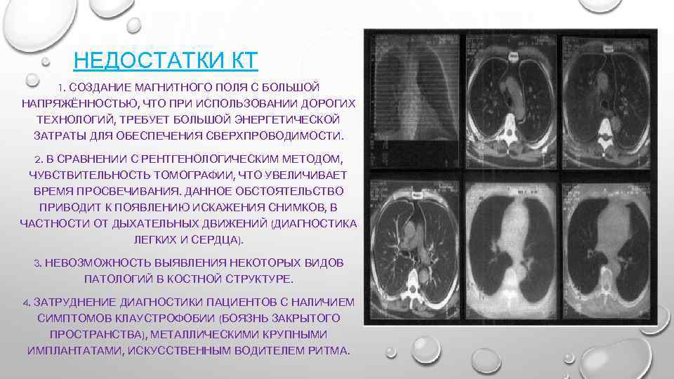 НЕДОСТАТКИ КТ 1. СОЗДАНИЕ МАГНИТНОГО ПОЛЯ С БОЛЬШОЙ НАПРЯЖЁННОСТЬЮ, ЧТО ПРИ ИСПОЛЬЗОВАНИИ ДОРОГИХ ТЕХНОЛОГИЙ,