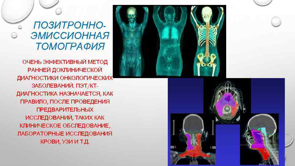 ПОЗИТРОННОЭМИССИОННАЯ ТОМОГРАФИЯ ОЧЕНЬ ЭФФЕКТИВНЫЙ МЕТОД РАННЕЙ ДОКЛИНИЧЕСКОЙ ДИАГНОСТИКИ ОНКОЛОГИЧЕСКИХ ЗАБОЛЕВАНИЙ. ПЭТ/КТДИАГНОСТИКА НАЗНАЧАЕТСЯ, КАК ПРАВИЛО,