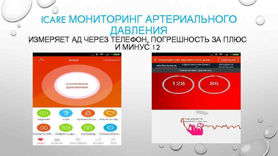 ICARE МОНИТОРИНГ АРТЕРИАЛЬНОГО ДАВЛЕНИЯ ИЗМЕРЯЕТ АД ЧЕРЕЗ ТЕЛЕФОН, ПОГРЕШНОСТЬ ЗА ПЛЮС И МИНУС 12