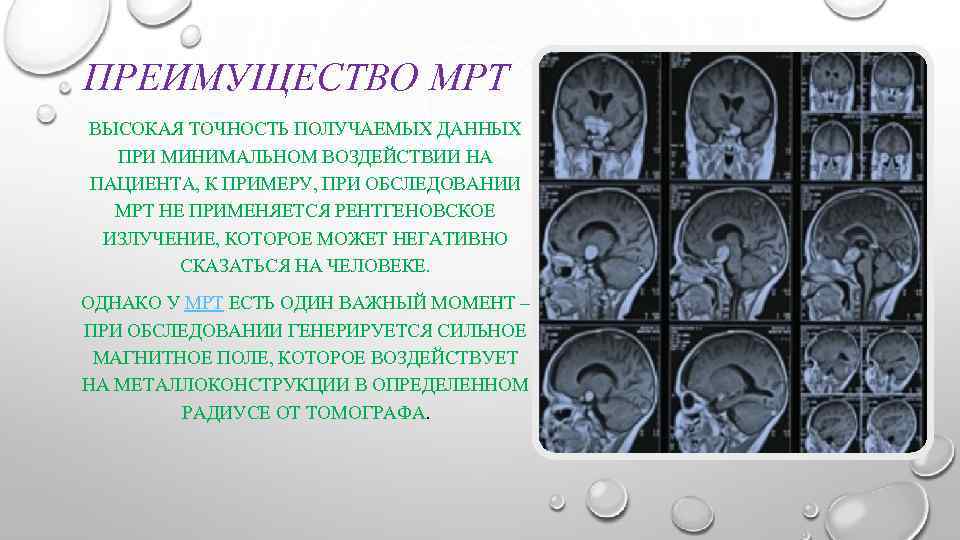 ПРЕИМУЩЕСТВО МРТ ВЫСОКАЯ ТОЧНОСТЬ ПОЛУЧАЕМЫХ ДАННЫХ ПРИ МИНИМАЛЬНОМ ВОЗДЕЙСТВИИ НА ПАЦИЕНТА, К ПРИМЕРУ, ПРИ