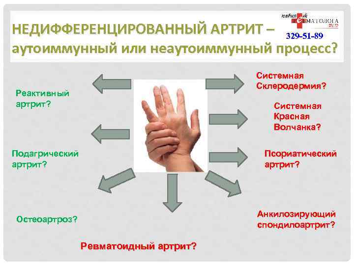 Артриту нет форум. Недифференцированный артрит симптомы. Недифференцированный периферический артрит. Недифференцированный паротит. Ревматоидный недифференцированный артрит.