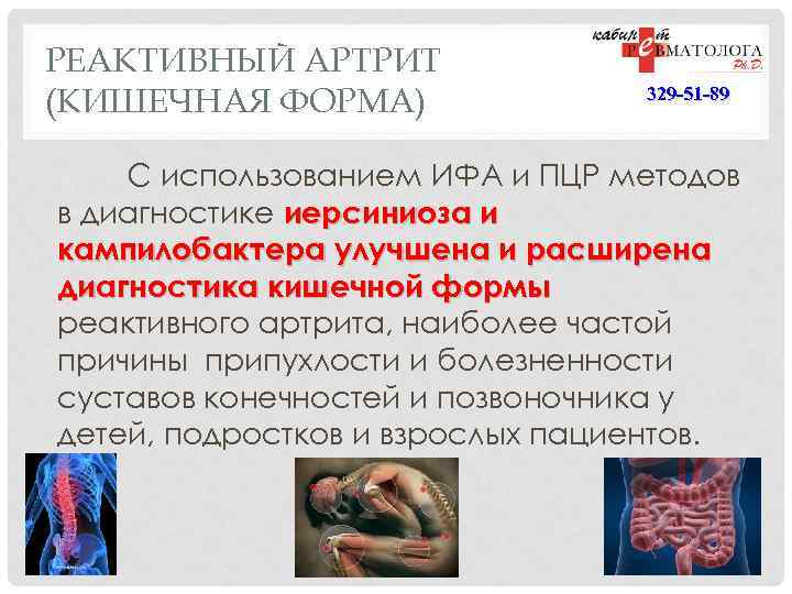 РЕАКТИВНЫЙ АРТРИТ (КИШЕЧНАЯ ФОРМА) 329 -51 -89 С использованием ИФА и ПЦР методов в
