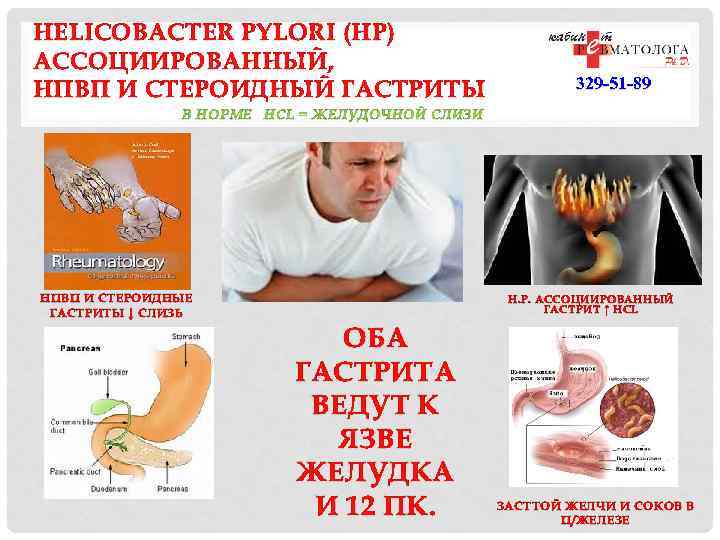 Helicobacter pylori alimentos prohibidos
