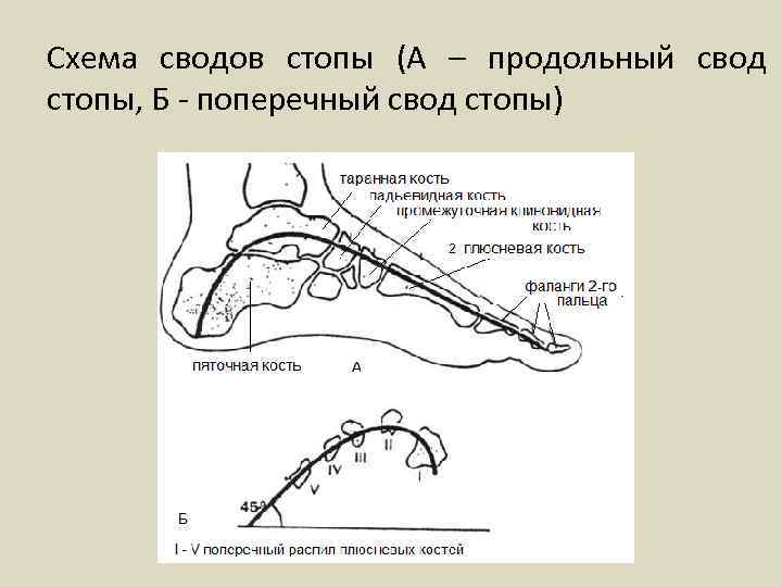 Схема сводов стопы (А – продольный свод стопы, Б - поперечный свод стопы) 